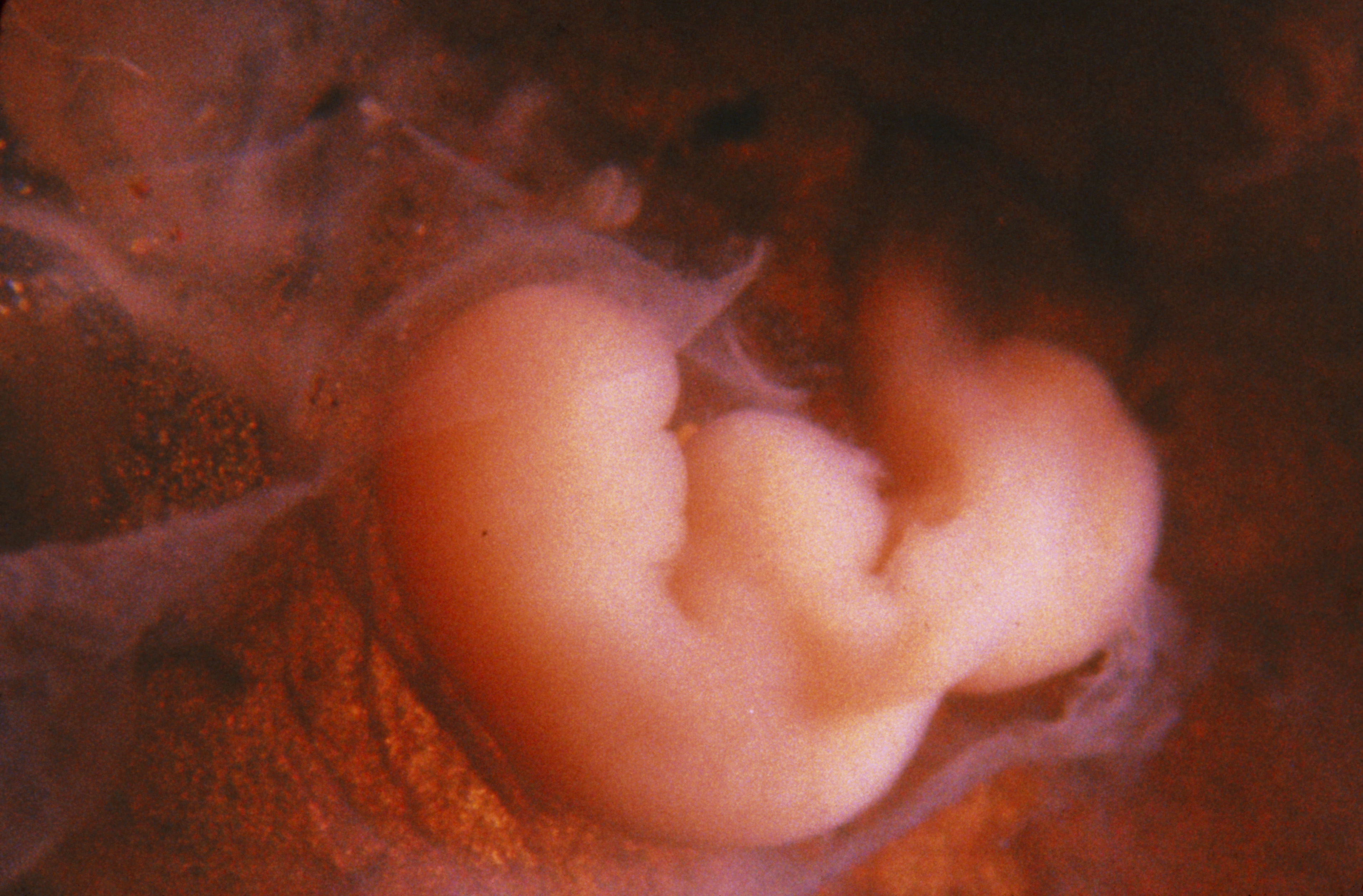 Плод сроком 4 недели. Эмбрион на 4 неделе беременности фото. Эмбрион на 2 неделе беременности фото.